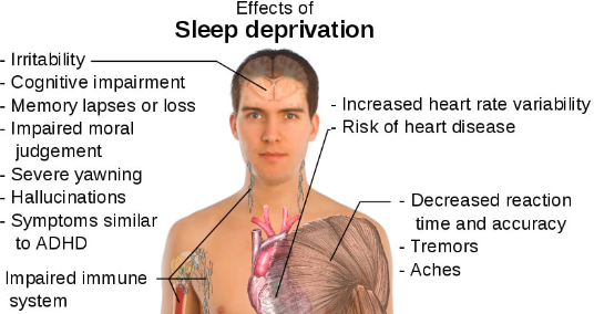 Highest Effects of sleep deprivation on health