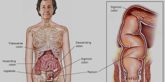 Things we don’t know about Colorectal Cancer